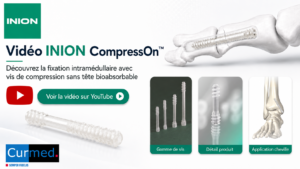Vidéo CompressOn Inion 